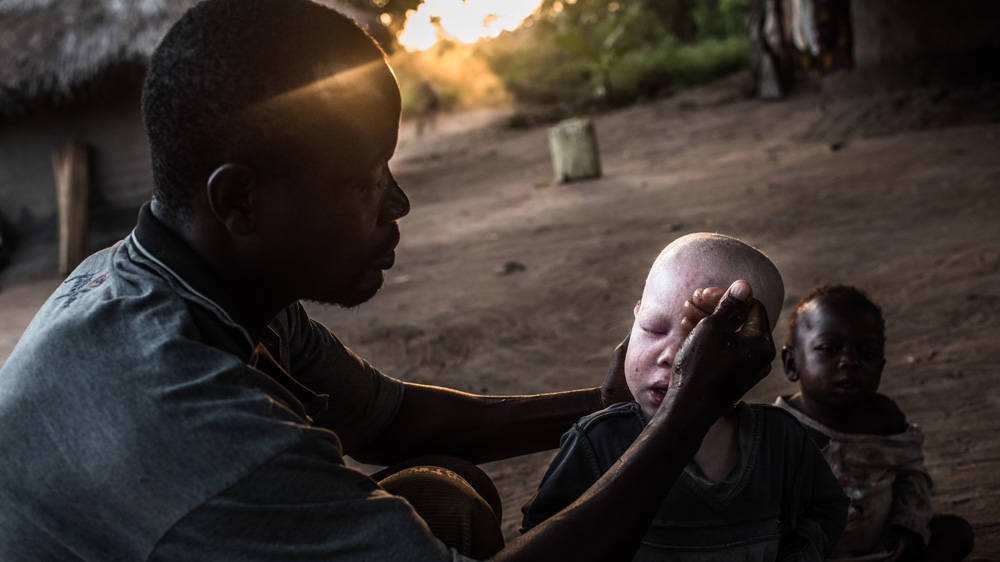 Mwanje washes his children Sekiringa and Marry in the morning, and applies sun screen with SPF protection 50 to Sekiringa [Fredrik Lerneryd/Al Jazeera]