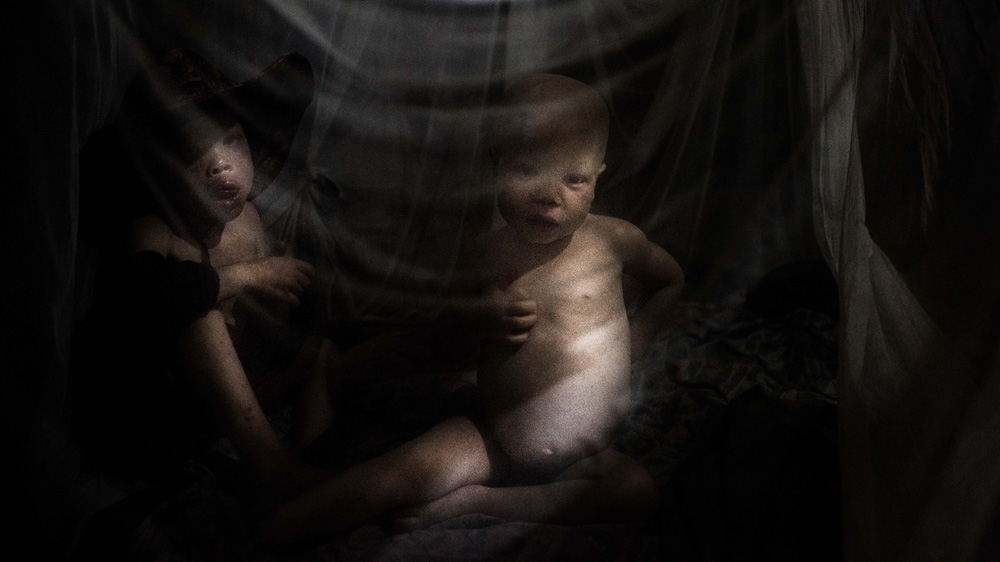 Mwanje and Sekirnga share the same mosquito net. Malaria is very common in these parts of the country and the family can't afford to give every child their own net [Fredrik Lerneryd/Al Jazeera]