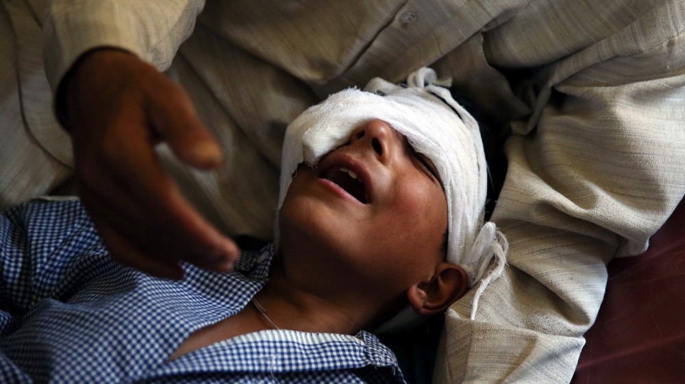 A father comforts his son whom he said was injured by pellets shot by security forces in Srinagar following weeks of violence in Kashmir