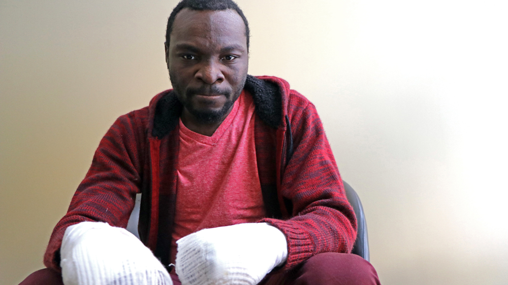 Seidu Mohammad also lost his fingers to frostbite during the crossing to Canada [Geraldine Malone/Al Jazeera]
