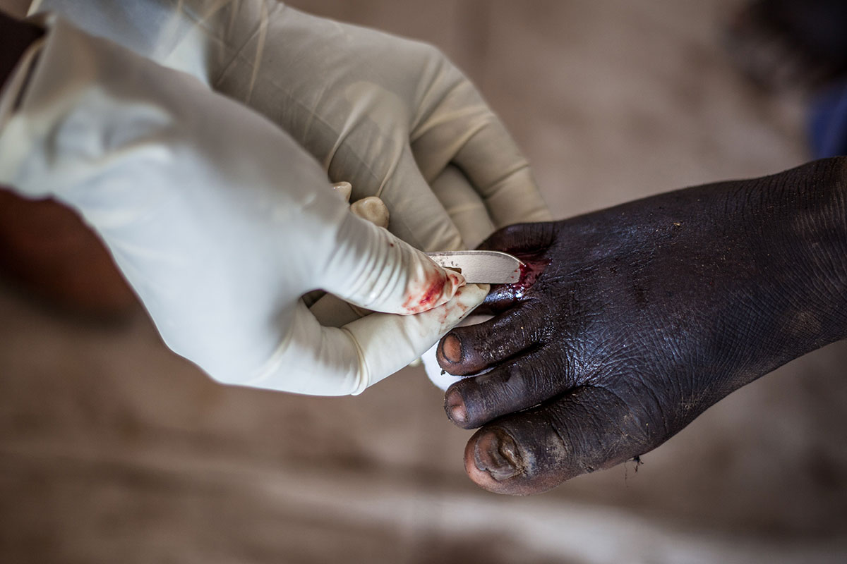 Massive exodus of Central Equatoria population/ Please Do Not use