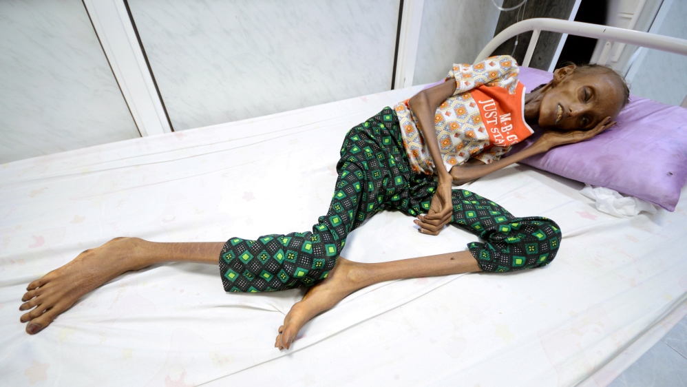 A Picture and its Story: Recovering from severe malnutrition in Yemen