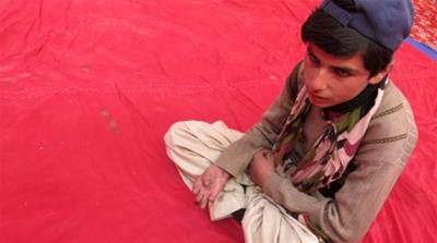 Umar Din lost the fingers on his right hand and was completely blinded in his left eye in a landmine explosion [Al Jazeera]