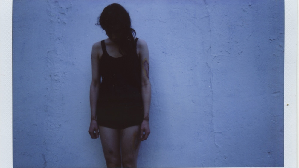 Potemkina poses as a victim for a portrait series in order to raise awareness of the physical toll of domestic abuse [Courtesy: Anastasia Potemkina]