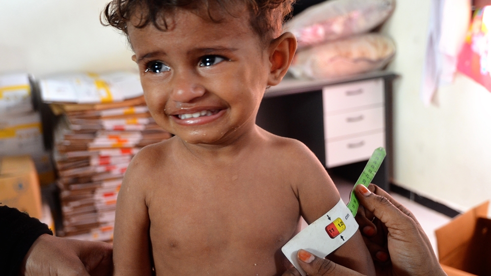 Malnourished Yemeni girl