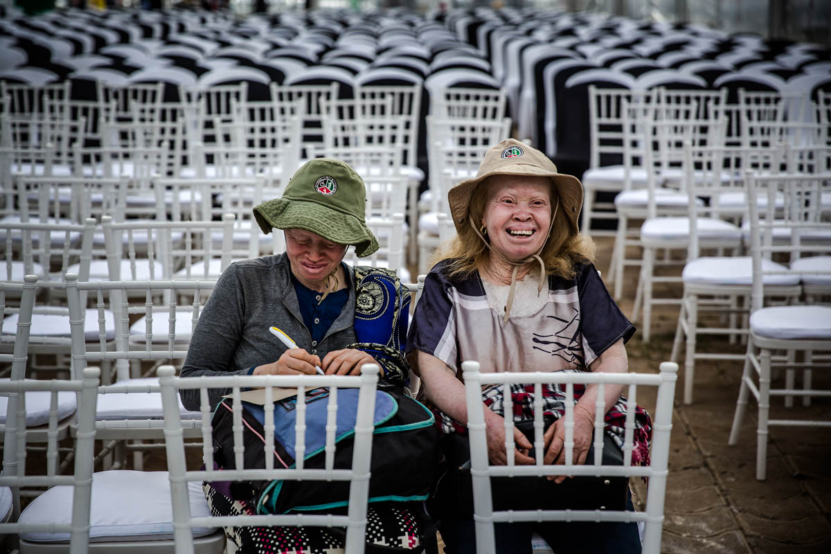 East Africa albino beauty pageant aims to fight social stigma