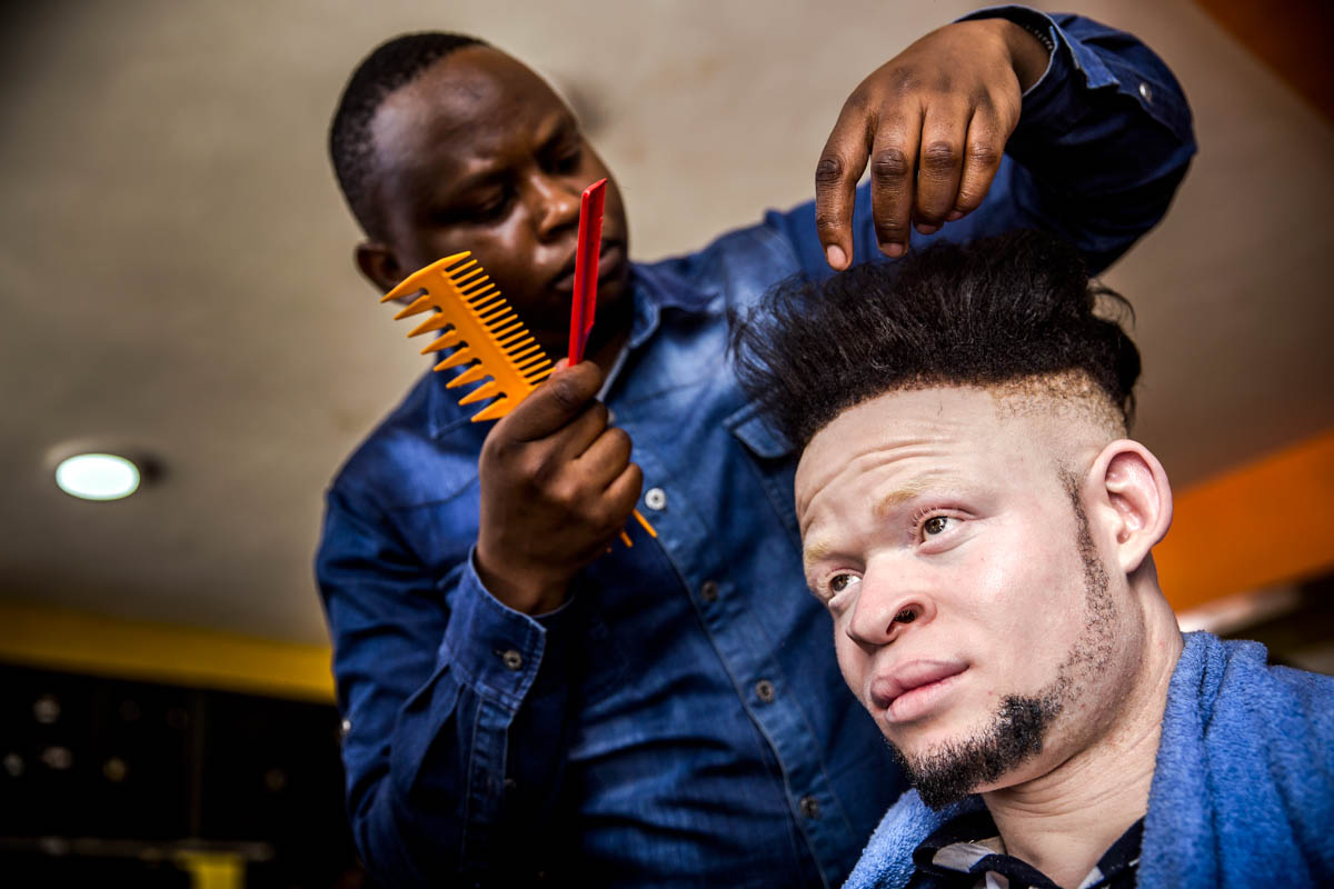 East Africa albino beauty pageant aims to fight social stigma