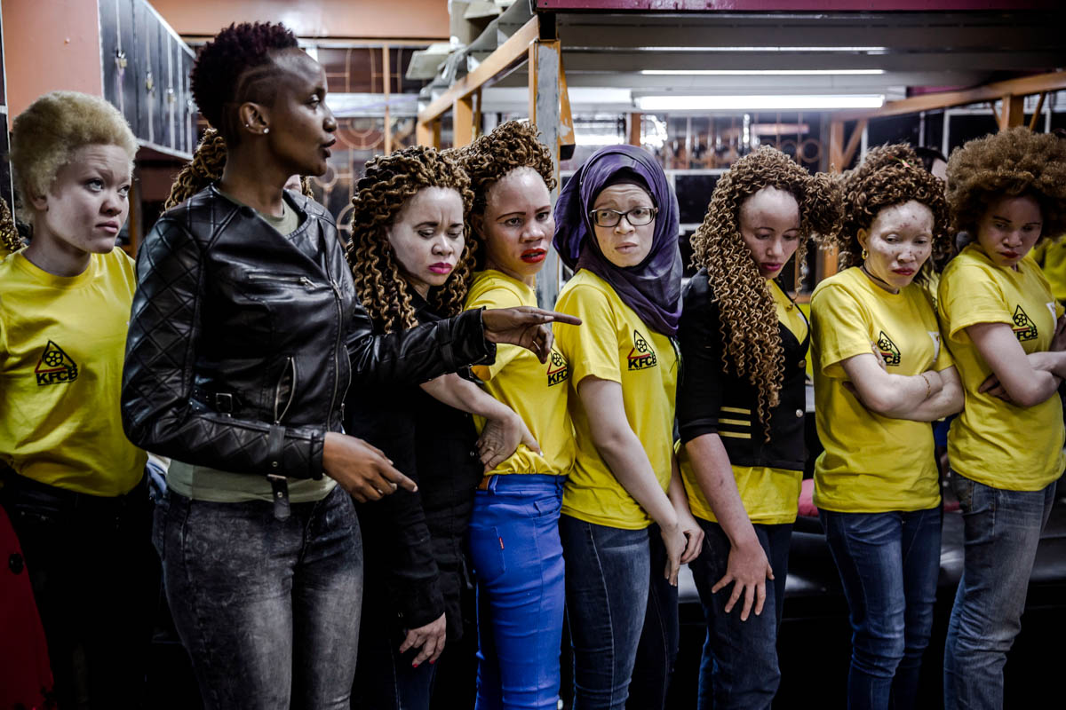 East Africa albino beauty pageant aims to fight social stigma