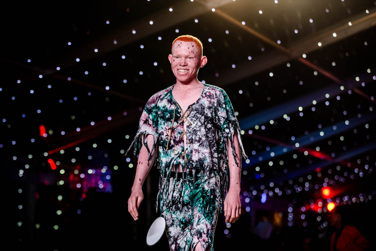 East Africa albino beauty pageant aims to fight social stigma