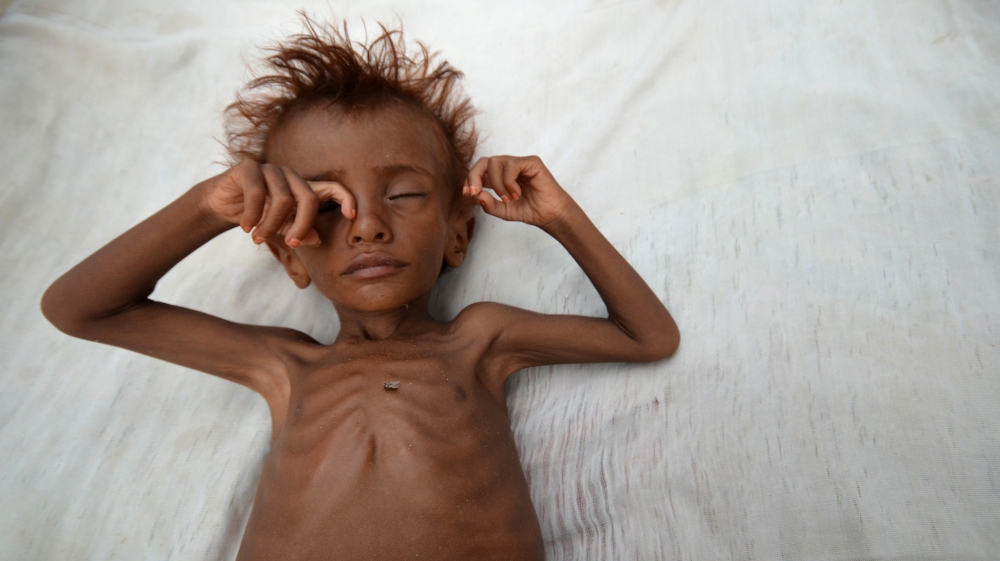 The Wider Image: Risk of famine looms in Yemen