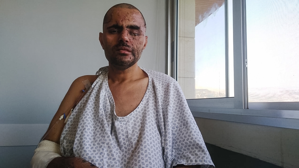 Mohamed Da’doey, 40, lost his left eye, a leg, and potentially his arm because of the blast [Courtesy: Mohamed Da’doey]