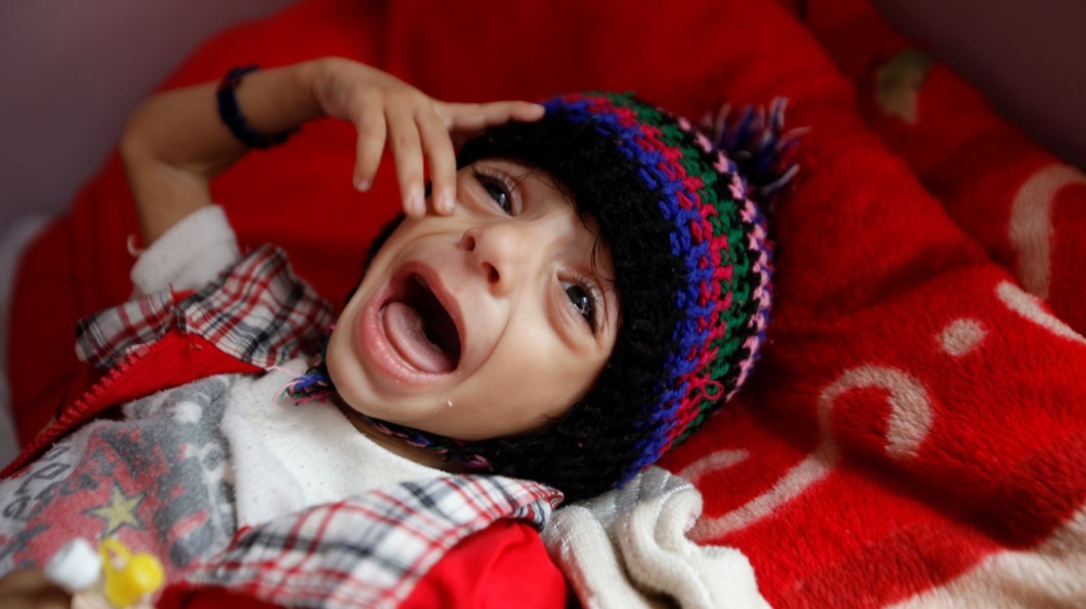 Risk of famine looms in Yemen