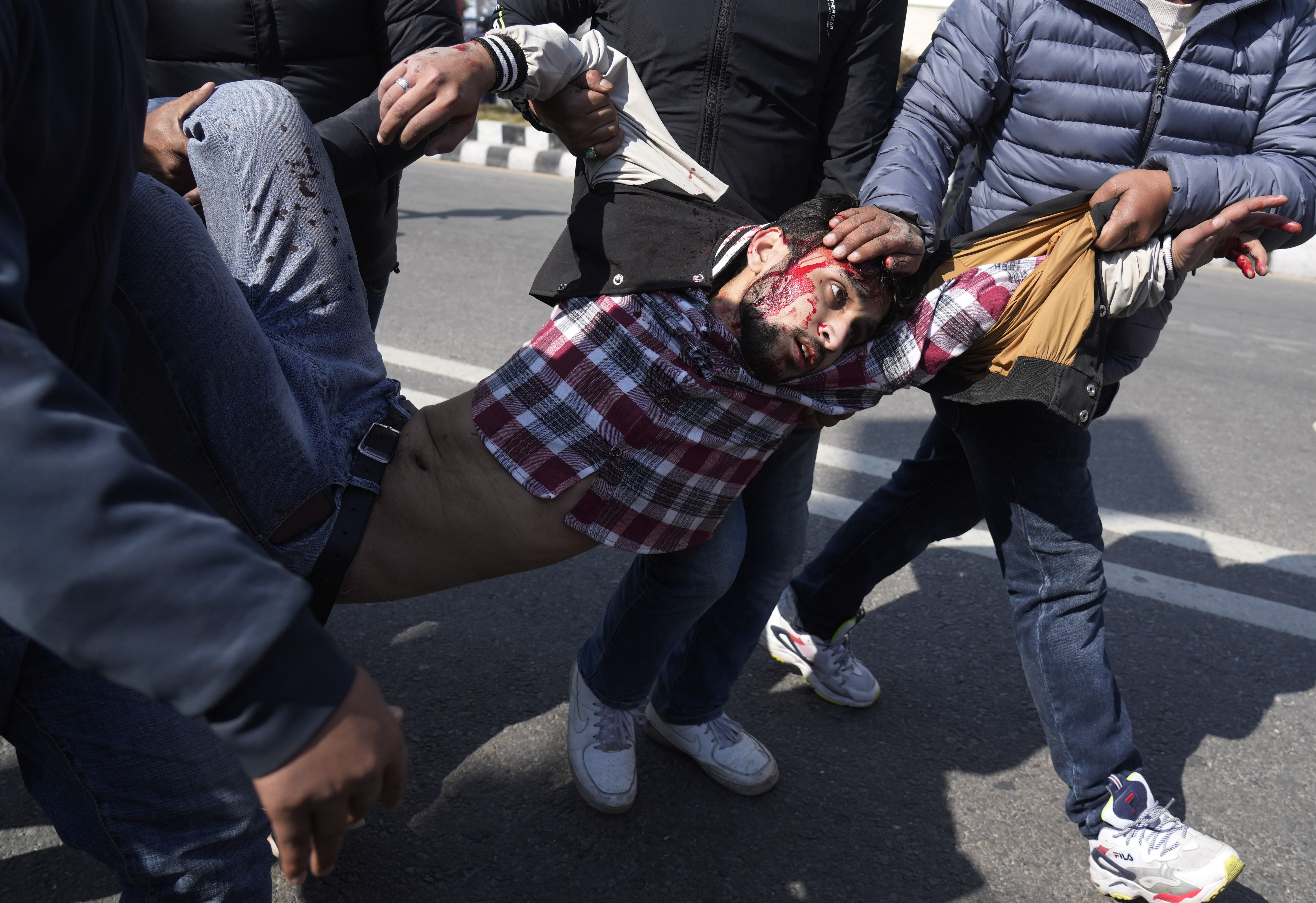 A injured protester is taken to hospital