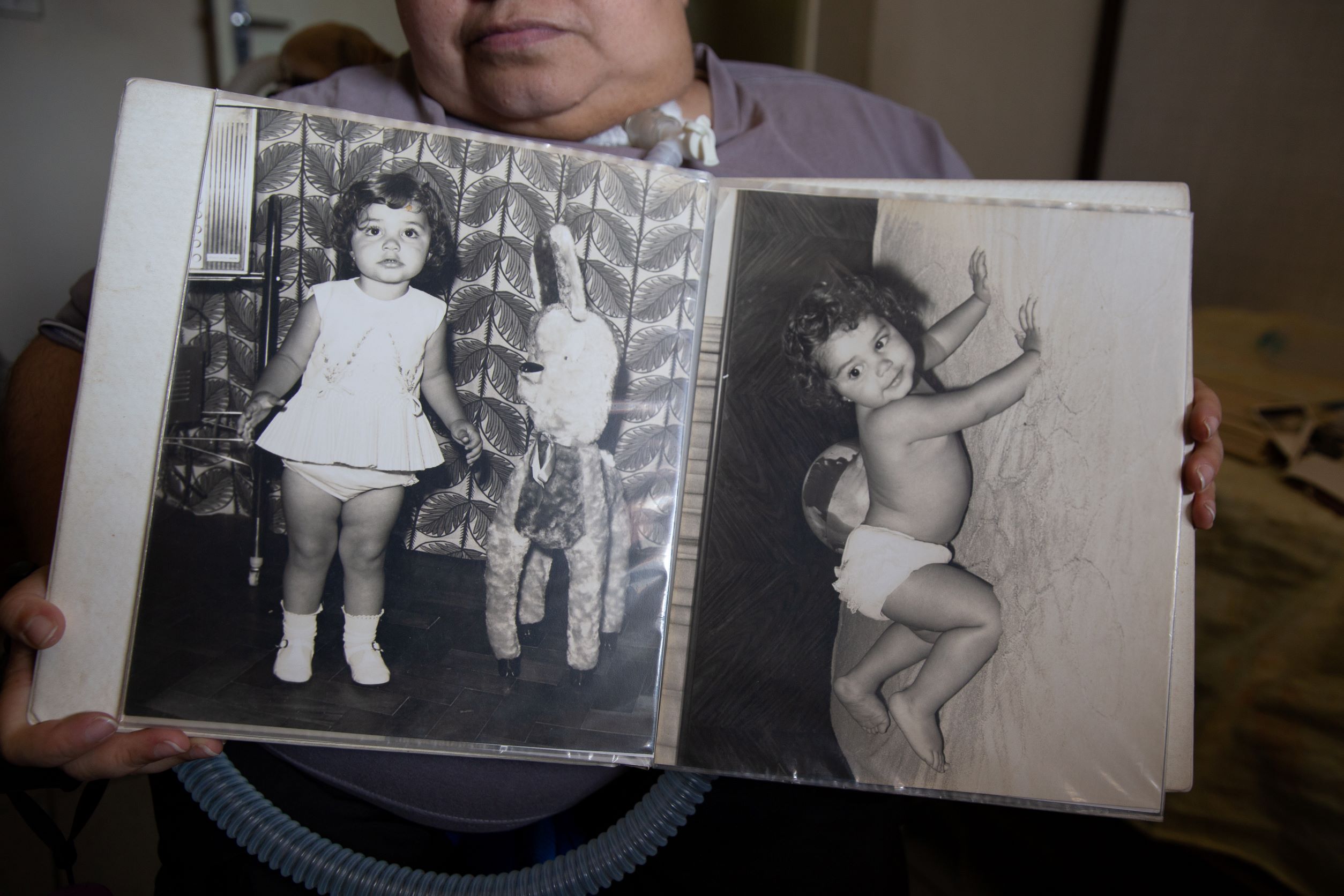 Polio survivor Eliana Goncalves holds up photos of herself before she was infected with polio