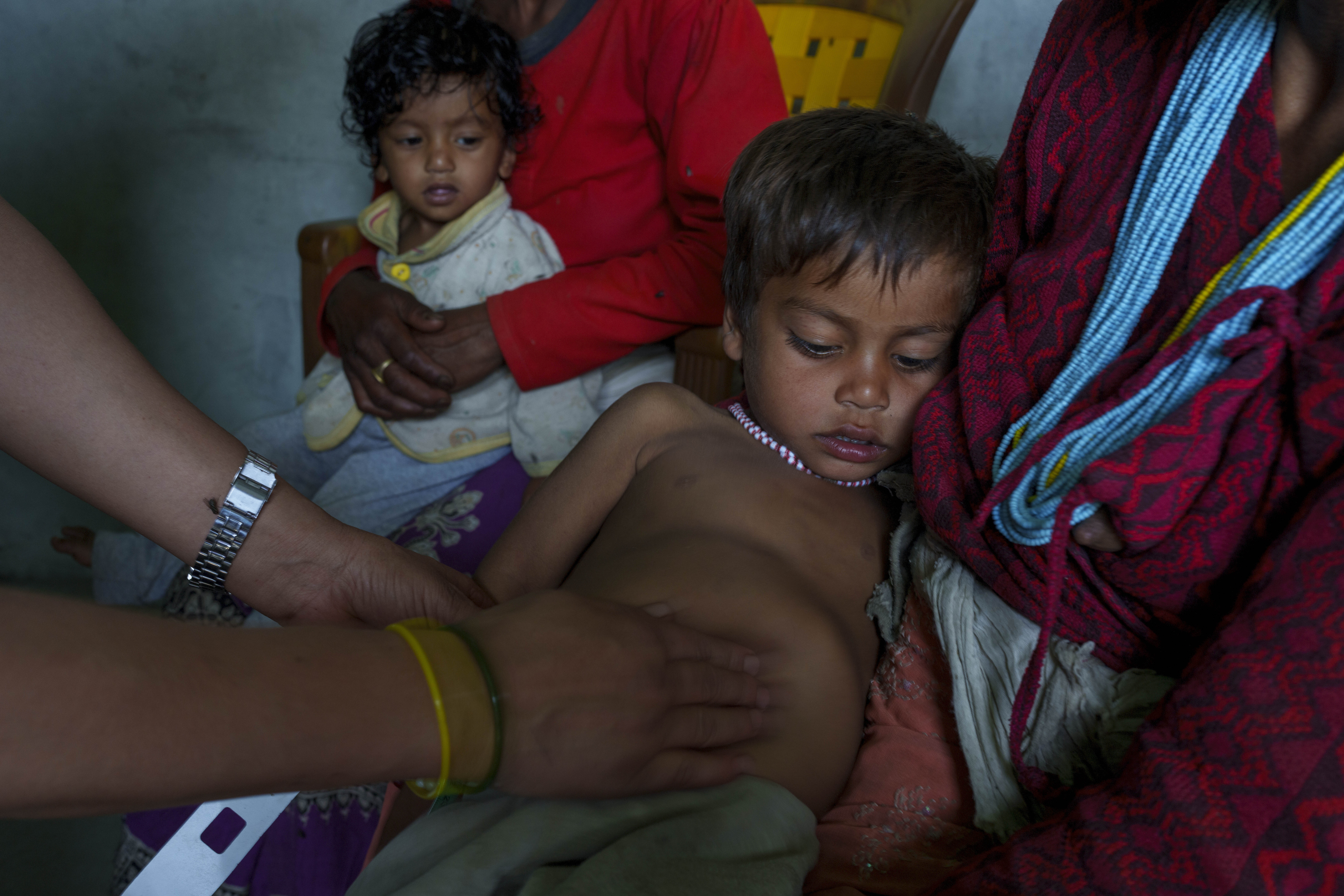 A Health worker inspect a swollen stomach of a malnourished child