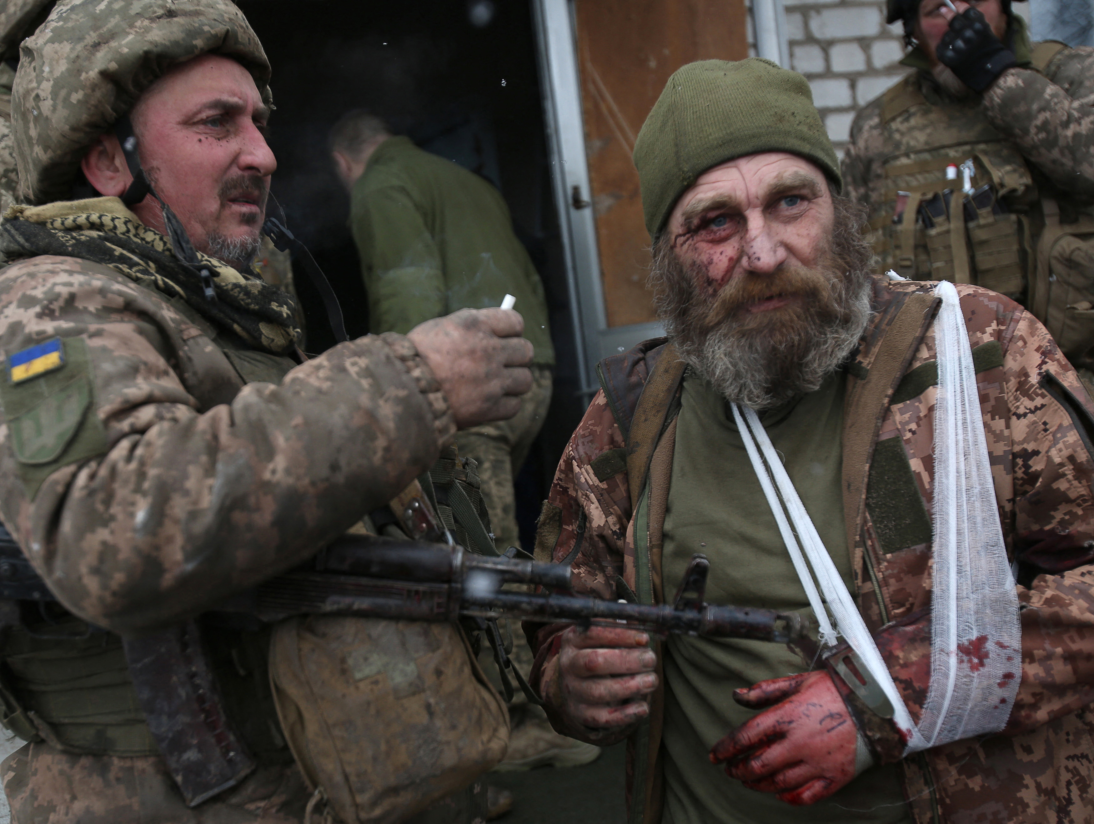 A wounded servicemen of Ukrainian Military Forces looks on after the battle with Russian troops and Russia-backed separatists in Luhansk region on March 8, 2022. - The number of refugees flooding across Ukraine's borders to escape towns devastated by shelling and air strikes passed two million, in Europe's fastest-growing refugee crisis since World War II, according to the United Nations.