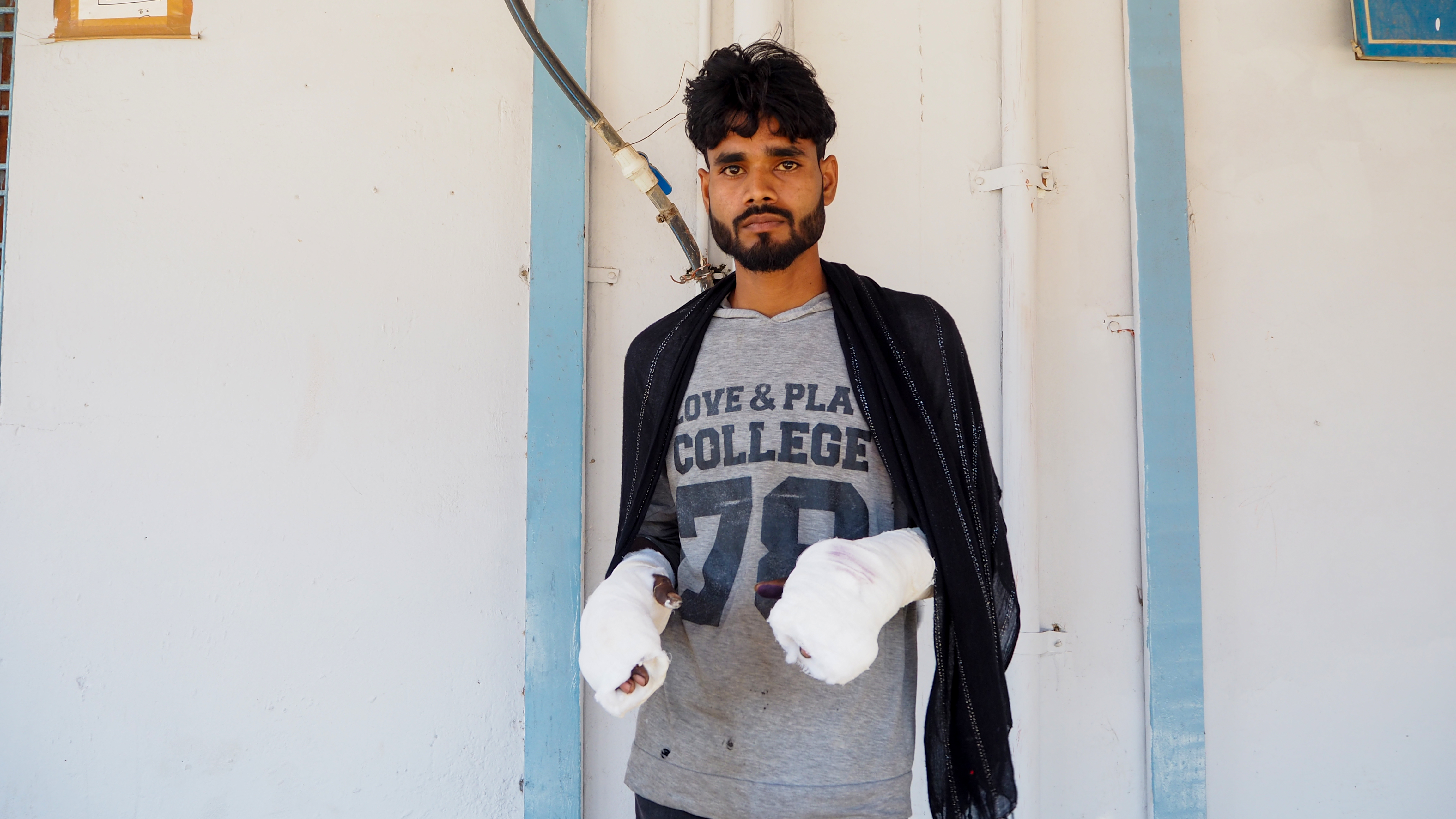 Shivpujan, 23 both hands got crushed under a power press machine while manufacturing bike spare parts in a factory situated in Manesar, Haryana, India