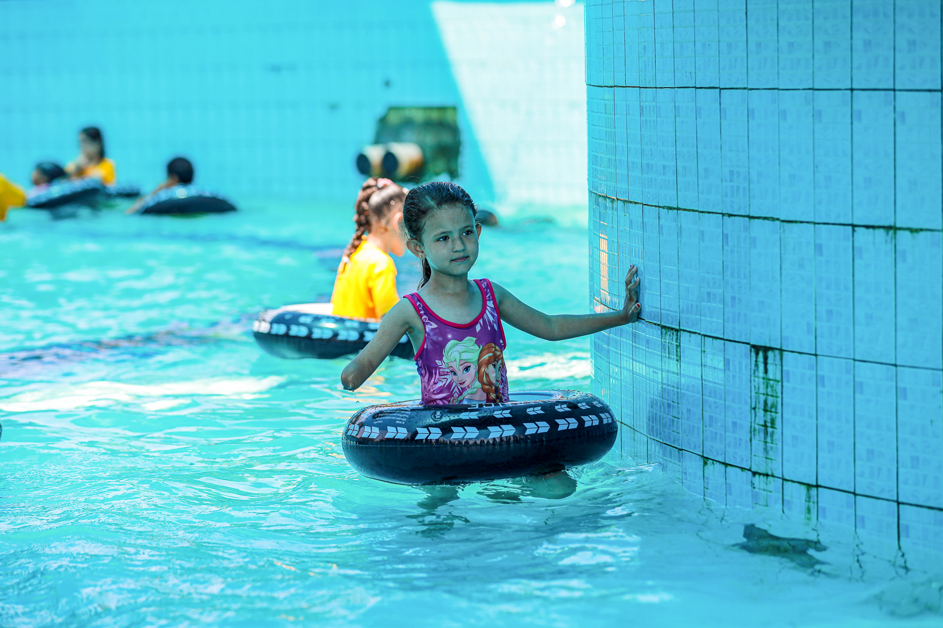 child amputees in Gaza