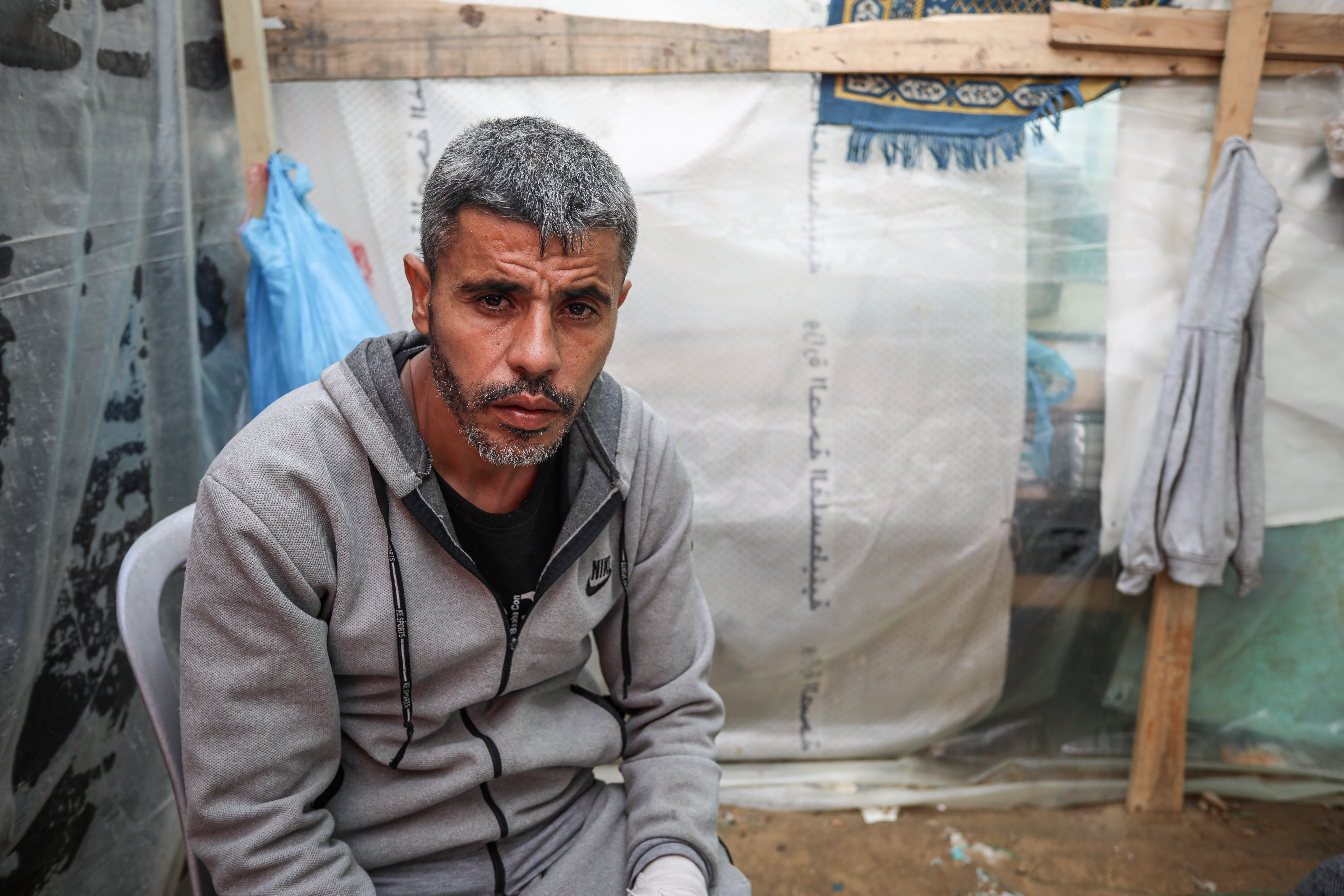 Ayman Harb, who was injured after Israeli warplanes targeted a market in Shujaiyeh, was forced to flee to central Gaza Strip with his family who are living in a tent for displaced people