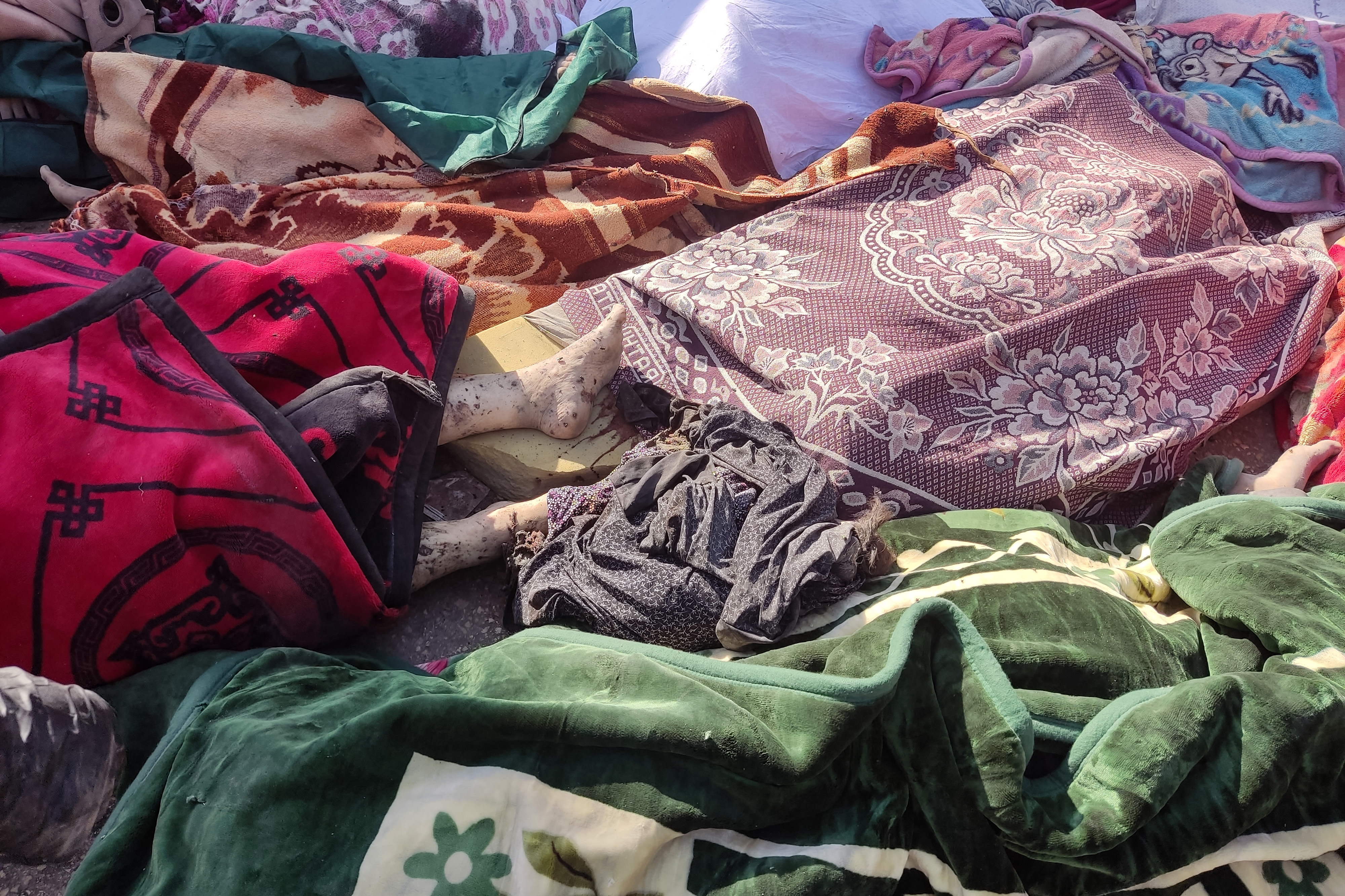 Graphic content / The bodies of people killed in bombardment that hit a school housing displaced Palestinians, lie on the ground in the yard of Al-Shifa hospital in Gaza City