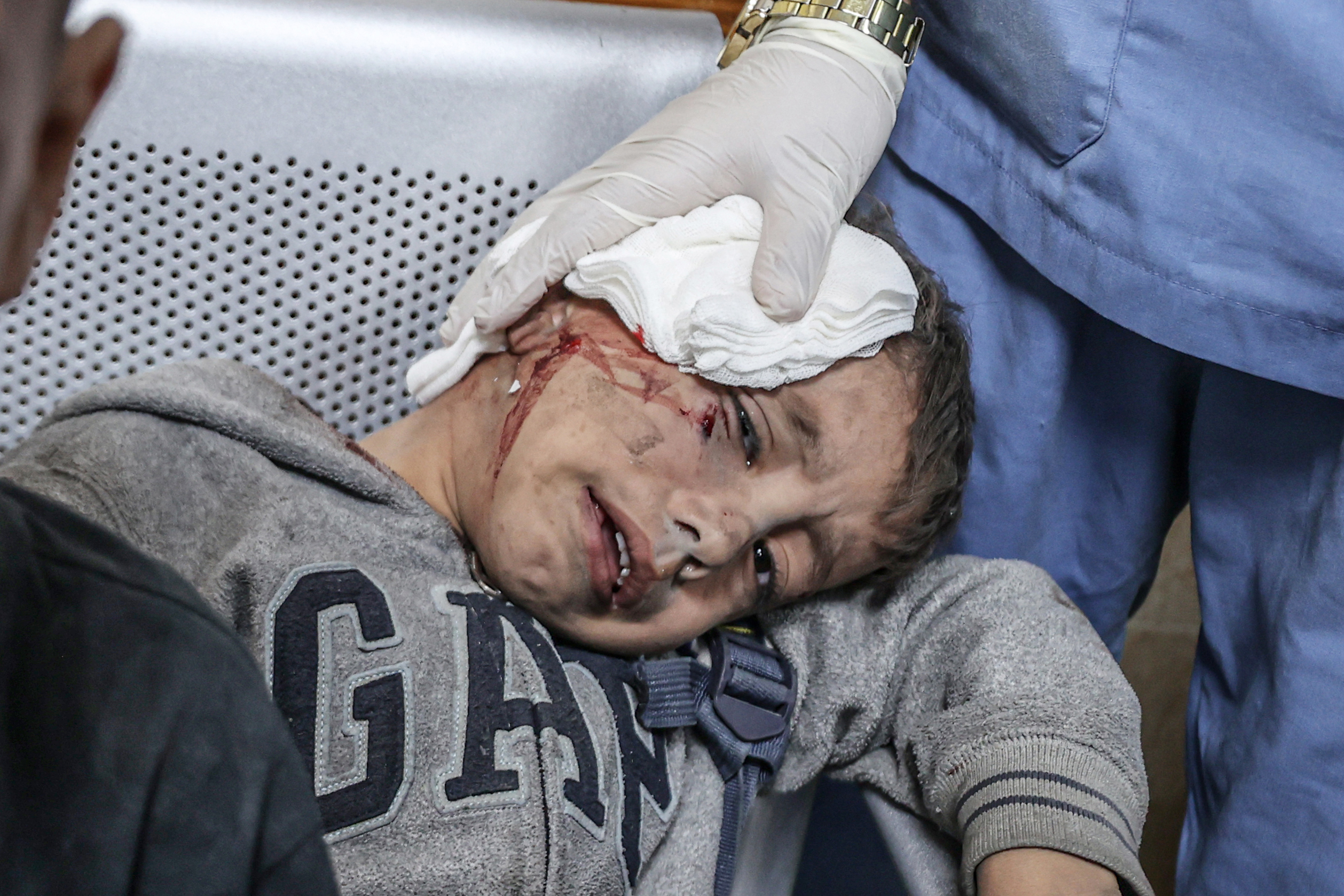 Image depicts graphic content) Injured people, including children, are brought to Al-Aqsa Martyrs Hospital for treatment after an Israeli attack following the humanitarian pause between Israel and Palestinian resistance group Hamas in Deir al-Balah, Gaza on December 02, 2023