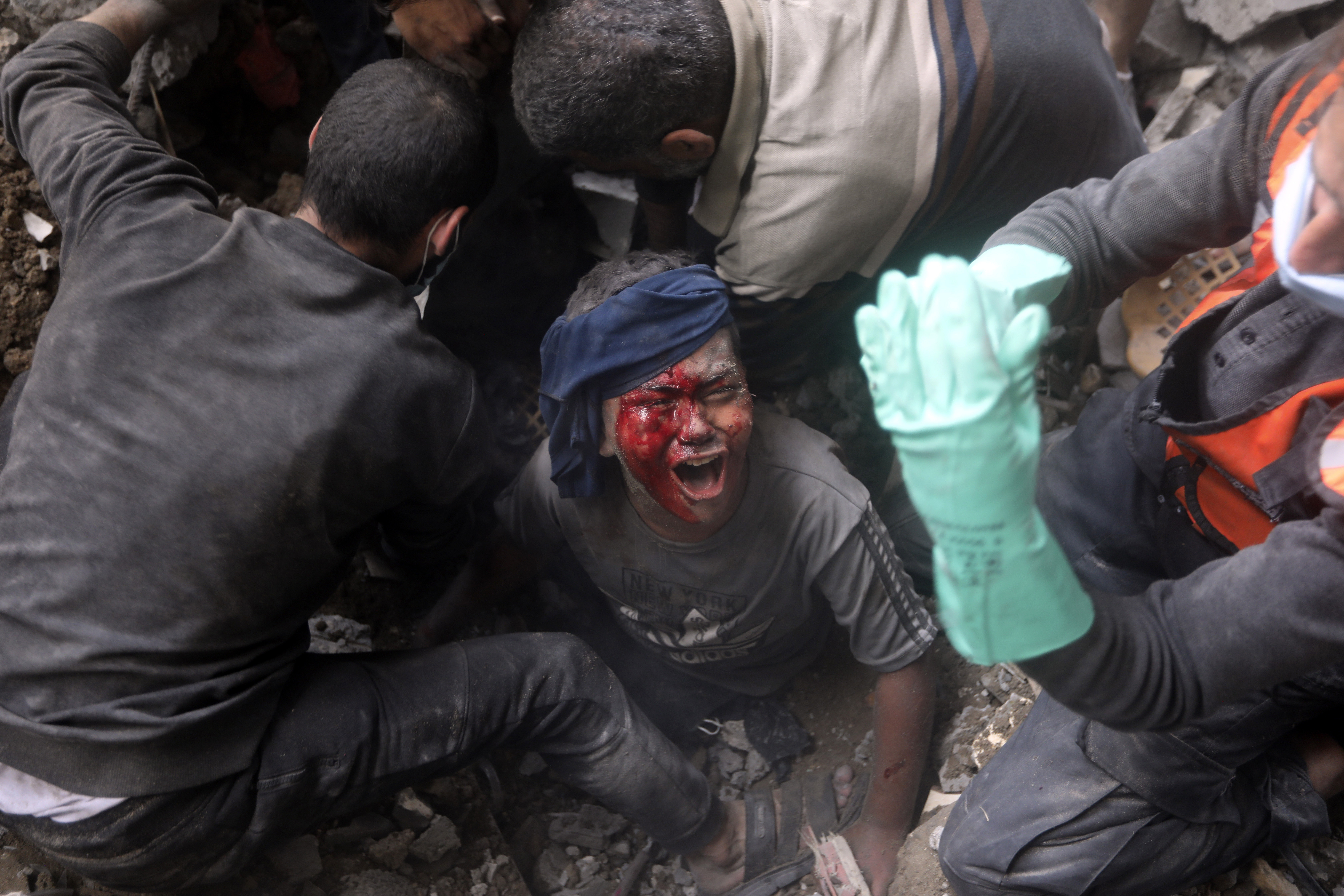 An injured Palestinian boy cries as rescuers try to pull him out of the rubble of a destroyed building following an Israeli airstrike in Bureij refugee camp