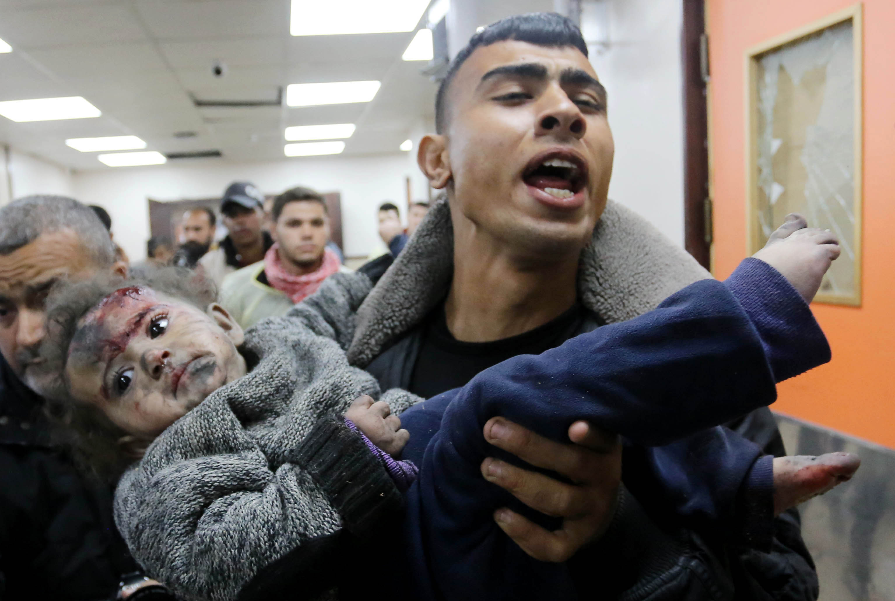 Palestinians including children are treated at Al-Aqsa Martyrs Hospital after being injured in Israeli attacks which killed 40 Palestinians and injured 100 others in Deir el-Balah, Gaza, on February 22, 2024 [Ashraf Amra/Anadolu Agency]