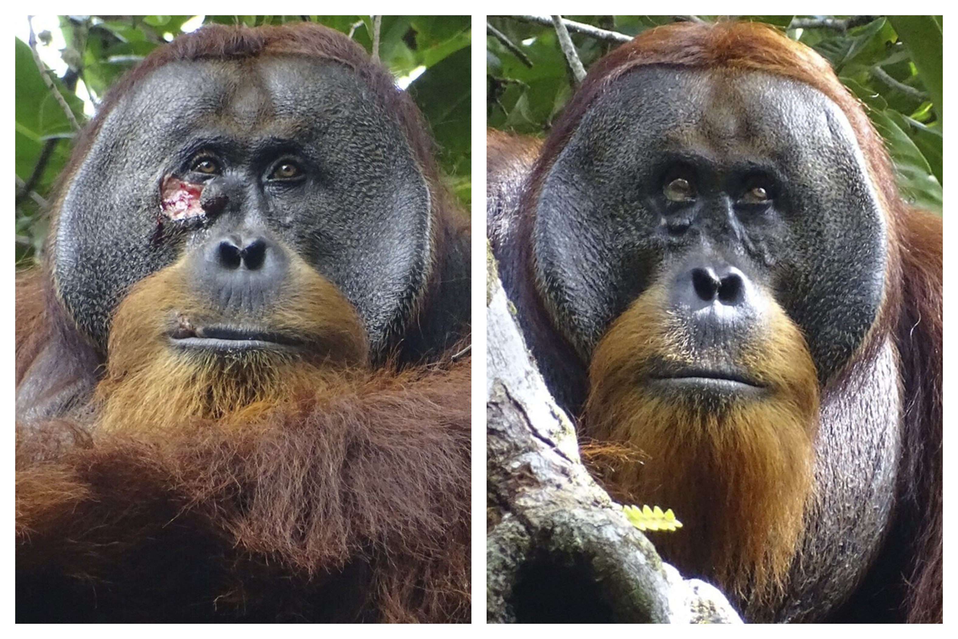 This combination of photos provided by the Suaq foundation shows a facial wound on Rakus, a wild male Sumatran orangutan in Gunung Leuser National Park