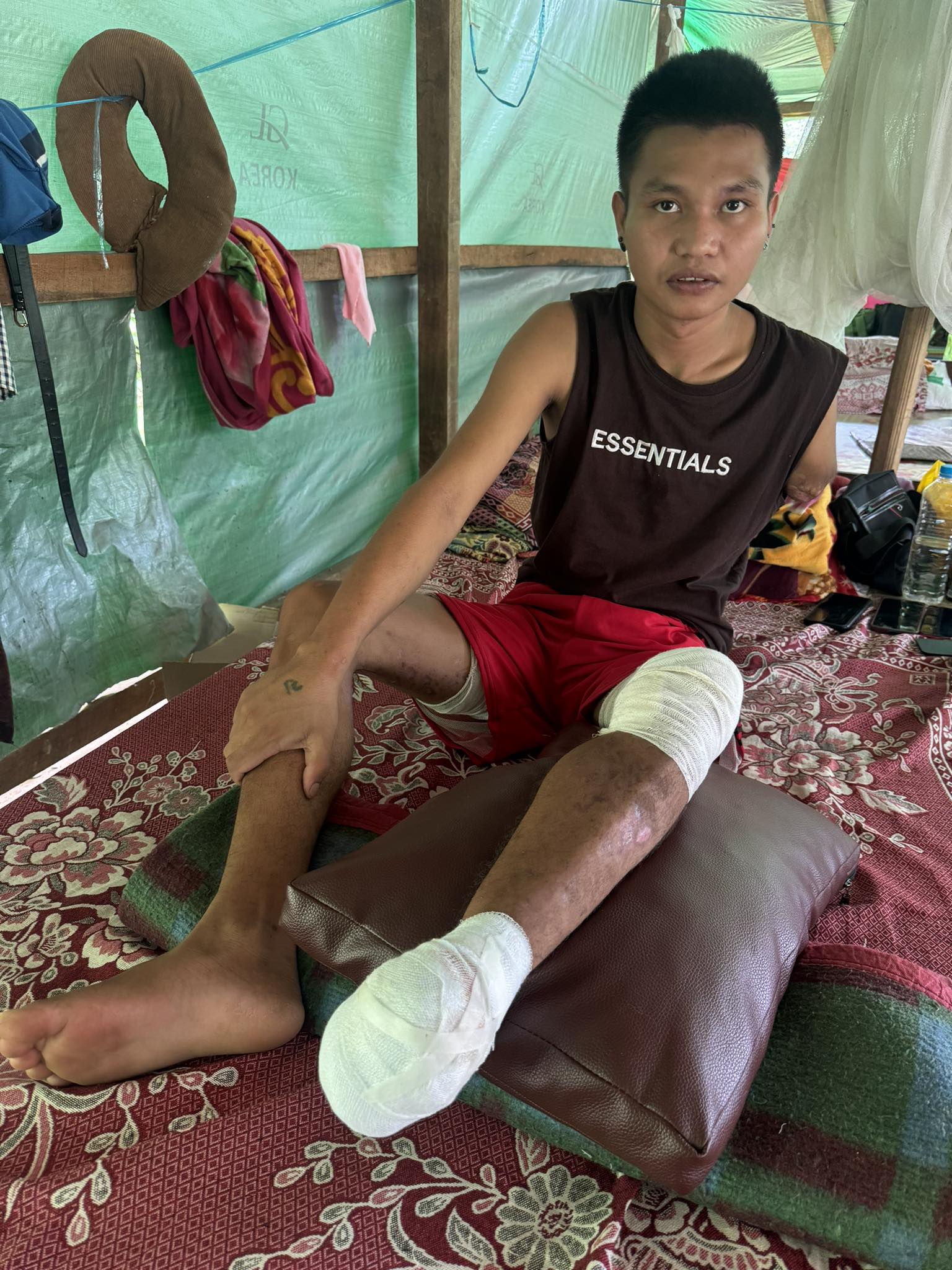Aung Nge sitting on a floor cushion in a shelter. He has large bandages around his left foot and knee. 