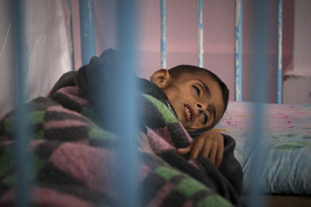 Osama al-Raqab, 5, in Gaza hospital