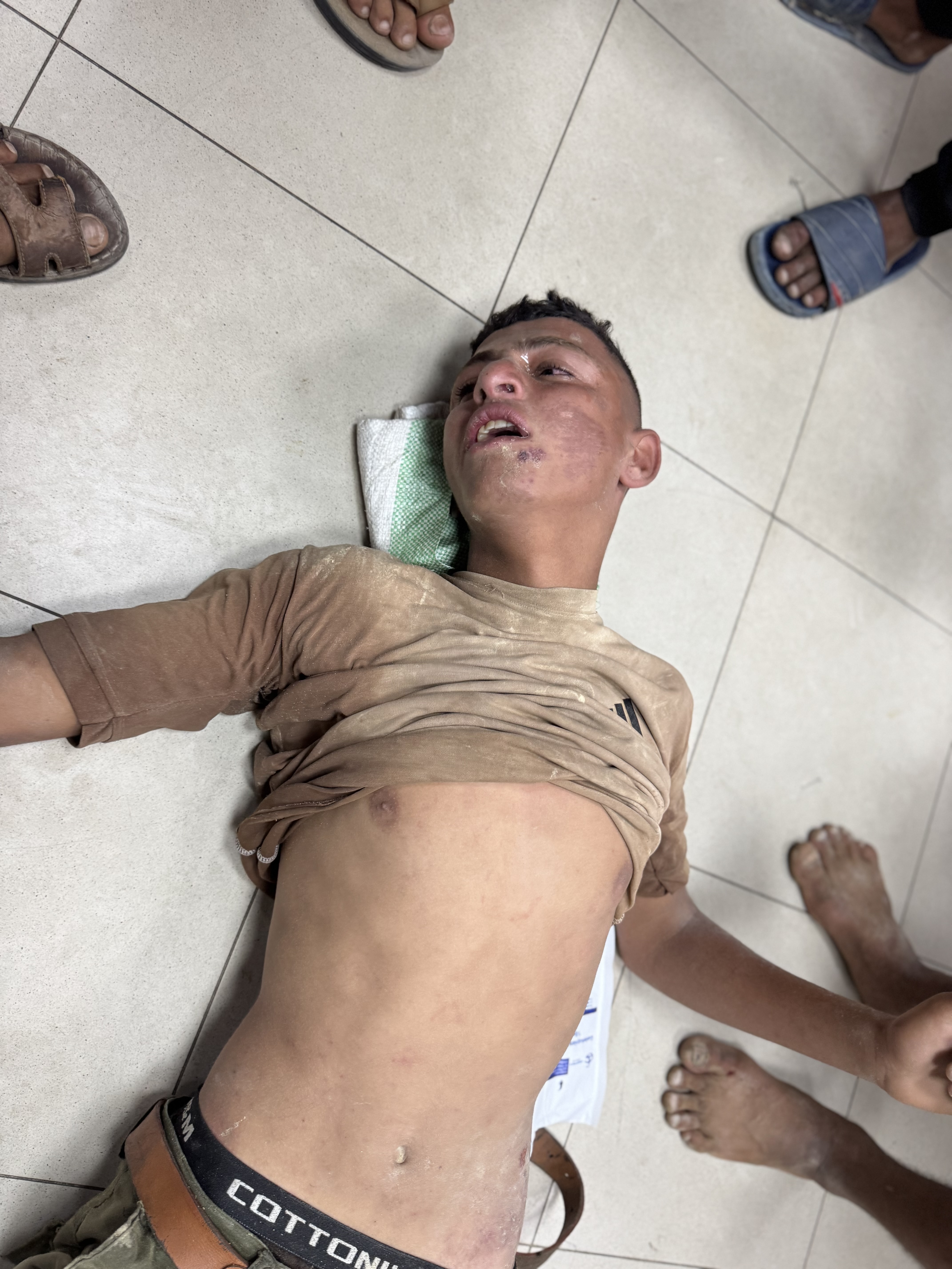 Hani Hamad was rushed unconscious to Nasser Hospital after the stampede near an aid site run by the controversial GHF
