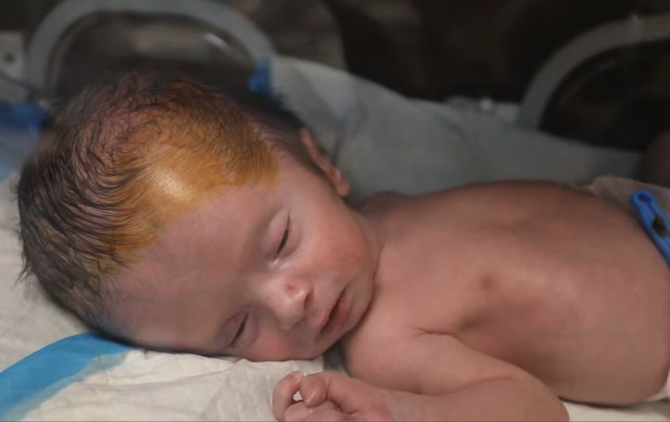 Young baby lies in a neonatal unit.