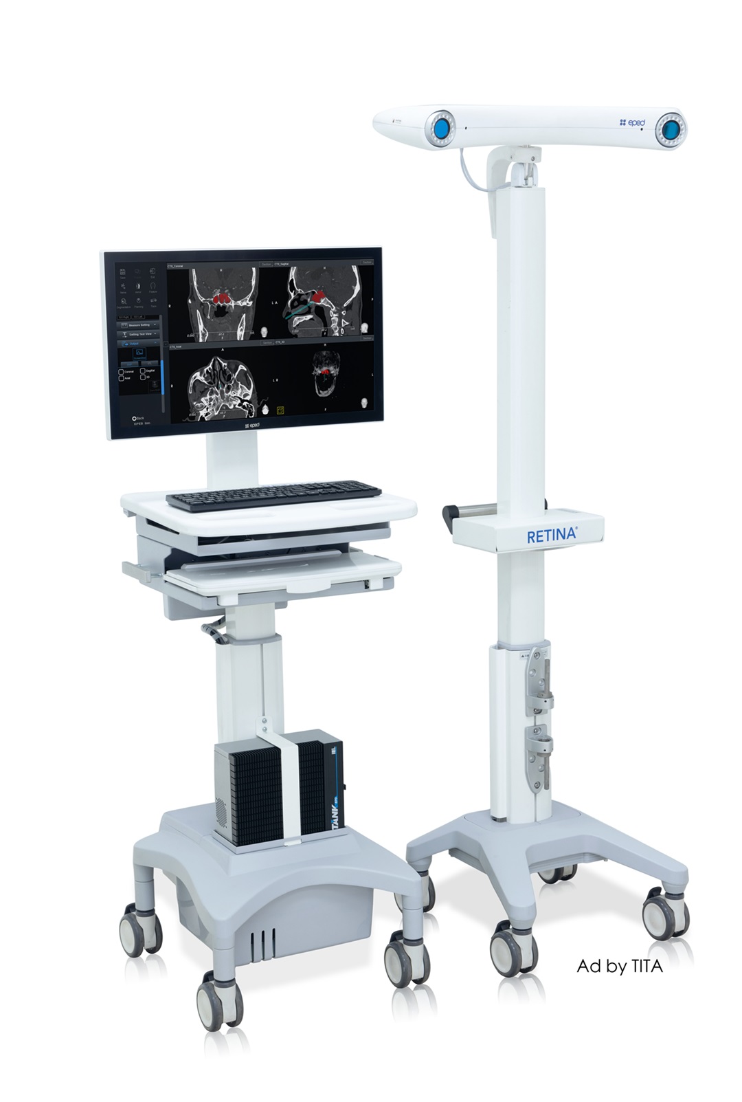 EPEDs RETINA Stereotactic surgical navigation system