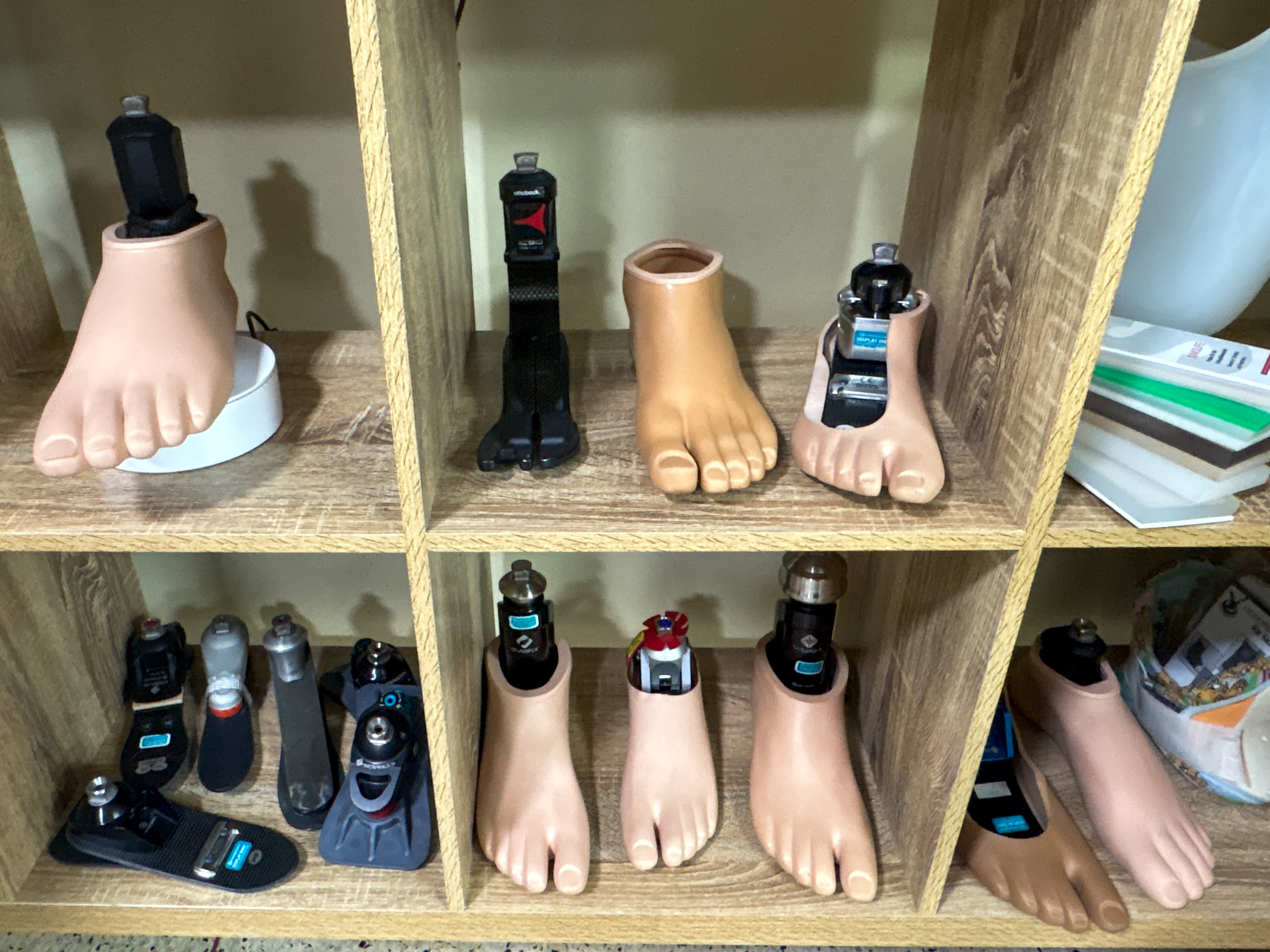 A display in the Ortoprotecnica clinic in Caracas shows different prosthetic attachments and skin shades